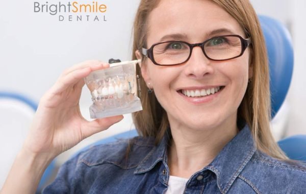 cost-of-full-mouth-dental-implants-columbus-ohio