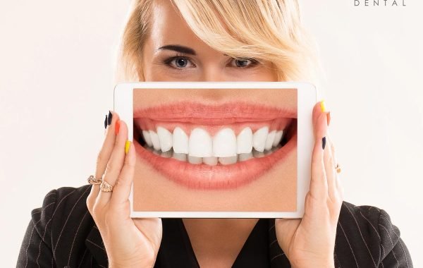 full-mouth-reconstruction-candidate