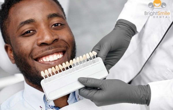 porcelain-veneers-cost-ohio