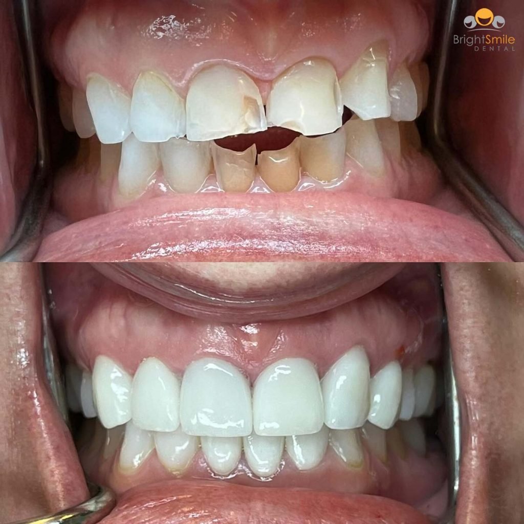 smile-makeover-columbus-ohio