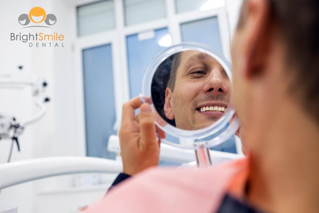 how-long-veneers-can-last