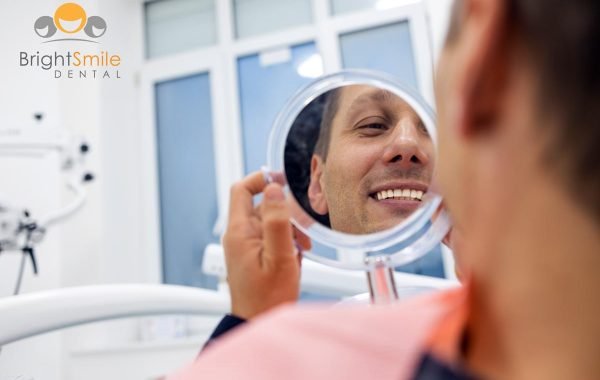 how-long-veneers-can-last