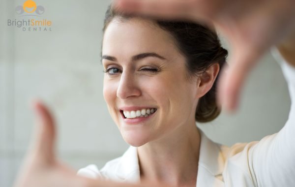How-Long-Do-Crowns-Last-on-Front-Teeth