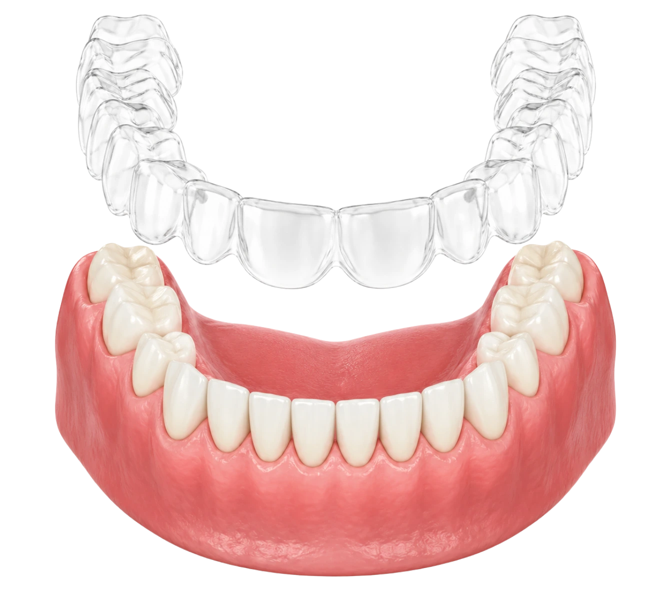 invisalign-powell-ohio