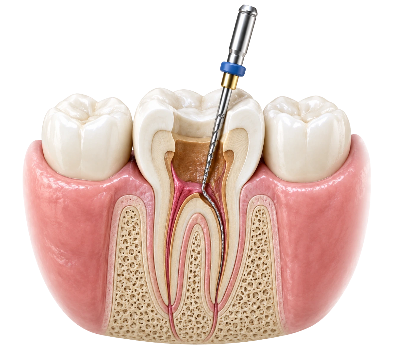 root-canals-powell-ohio