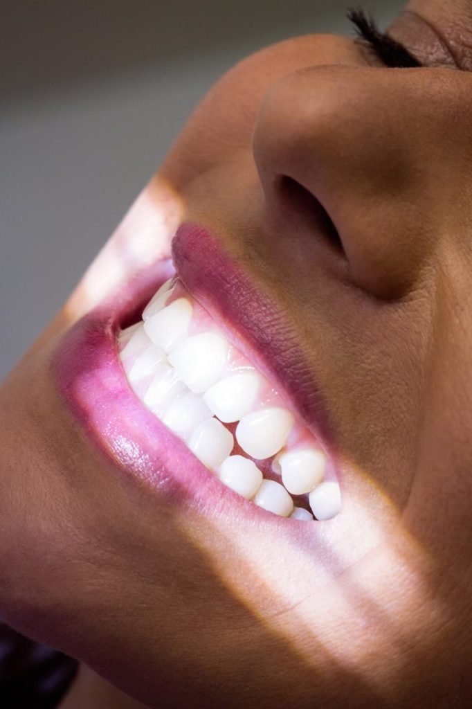 teeth-whitening-powell-oh