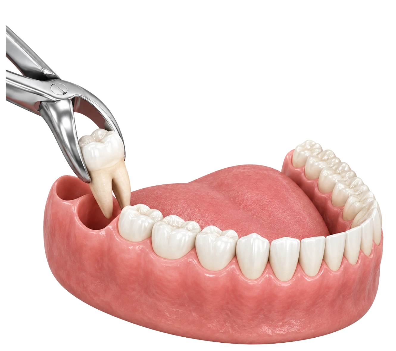 wisdom-teeth-removal-powell-ohio
